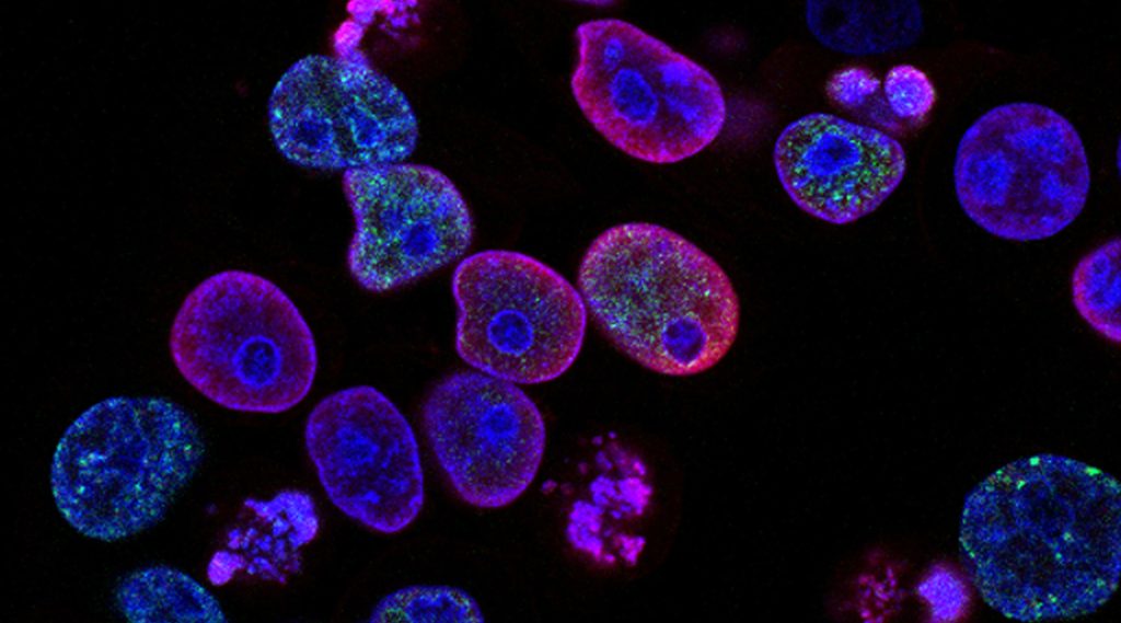 Cancer cells