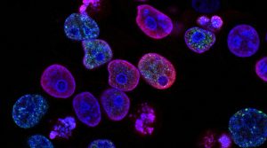 Cancer cells